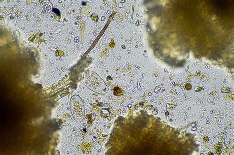 Microscope montrant les micro-organismes du compost
