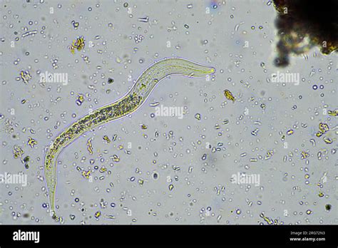 Nématodes au microscope