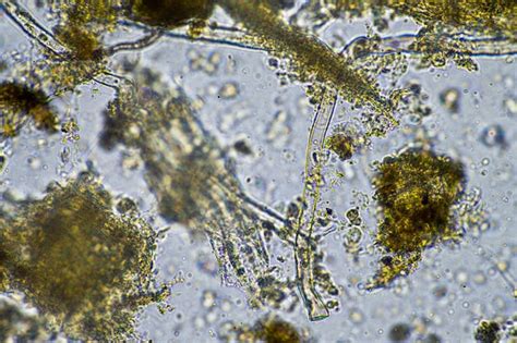 Microorganismes du sol sous microscope