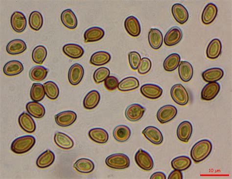 Microscope montrant des spores de champignons