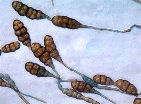 Alternaria tache brune (Alternaria alternata (Fr.) Keissl.)