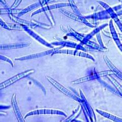 Photographie microscopique de macroconidies de Fusarium