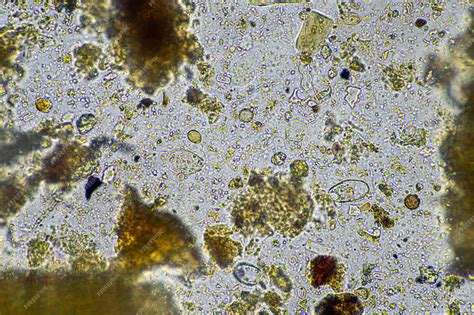 Microorganisms under microscope