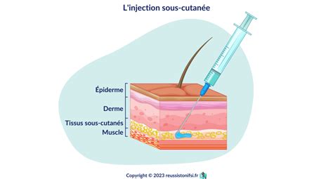 Schéma illustrant les zones de test cutané pour une teinture