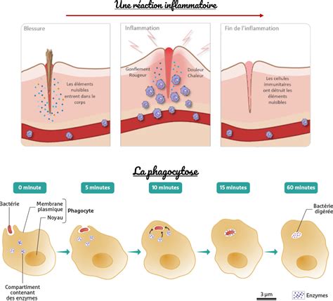 Schéma des mécanismes de l'inflammation