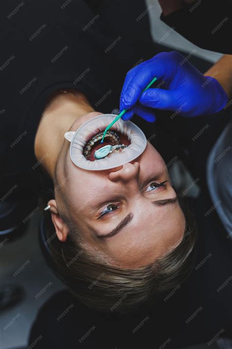 Gros plan sur les dents acérées du fil Techni-Blade