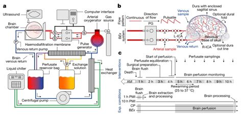 Schéma du système BrainEx pour la perfusion de cerveaux ex vivo