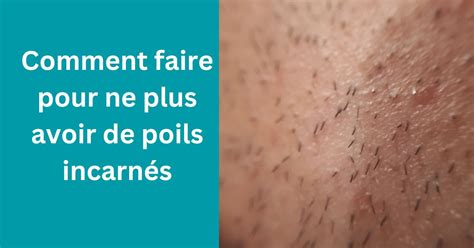 Infographie sur les causes et la prévention des poils incarnés