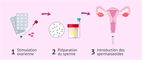 Schéma de l'insémination artificielle équine