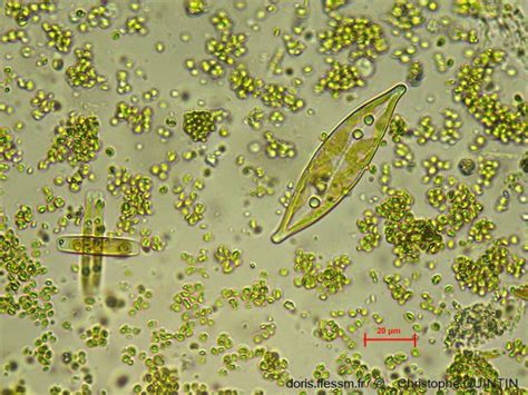 Diatomées vues au microscope