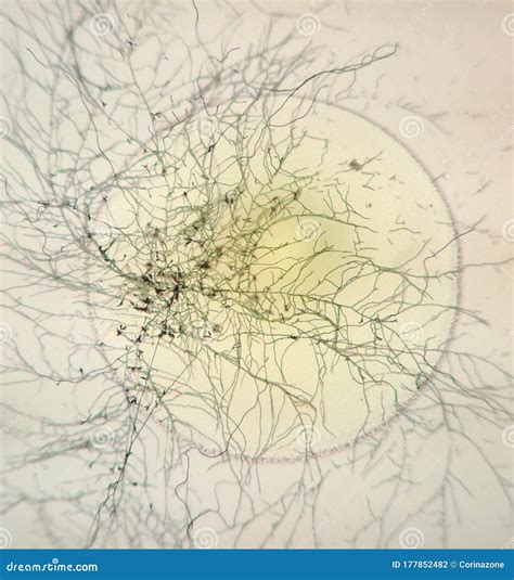 Champignons et bactéries au microscope