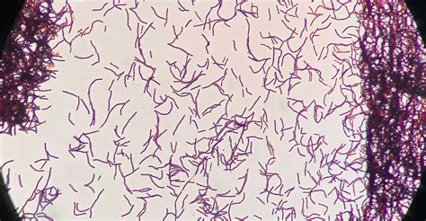Bacillus thuringiensis sous microscope