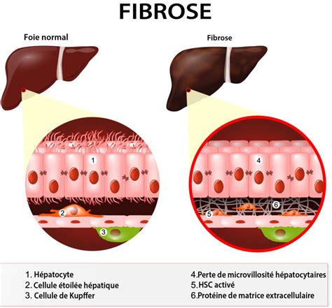 Fonctionnement du foie et impact de la fibrose