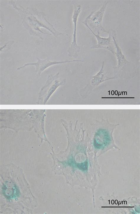 Photographies de fibroblastes de souris avant et après sénescence