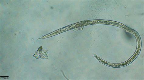 Nématodes Xiphinema index et Xiphinema diversicaudatum