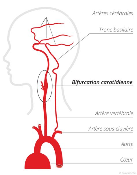 Diagramme des segments de la carotide interne, mettant en évidence le bulbe carotidien