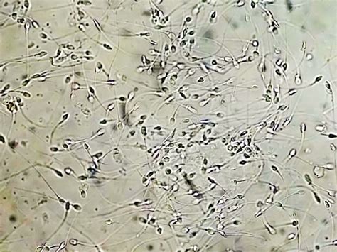 Analyse de spermatozoïdes au microscope