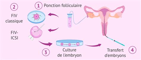 Schéma comparatif FIV classique vs FIV-ICSI