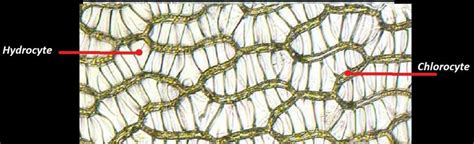 Feuille de sphaigne au microscope montrant chlorocytes et hydrocytes