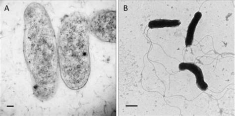 Microscope montrant la bactérie Bartonella Henselae