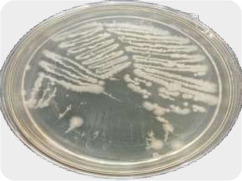 Bacillus thuringiensis culture en laboratoire
