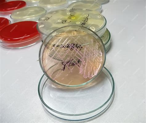 Image d'une boîte de Pétri avec des gamétophytes de Physcomitrella patens en culture