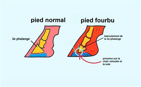 Diagramme des mécanismes de déclenchement de la fourbure