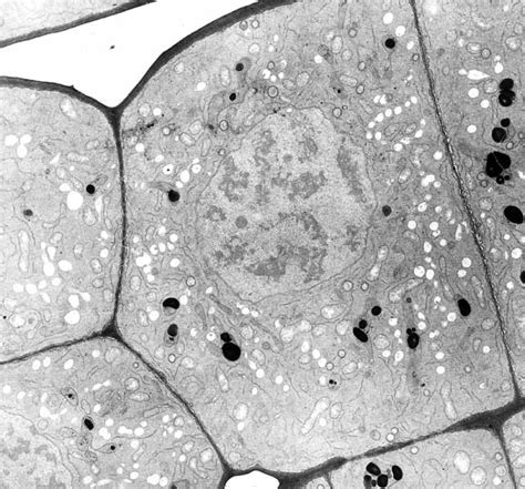 Microscope électronique affichant des cellules rénales