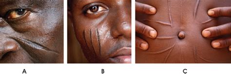 Schéma de scarification en passages croisés