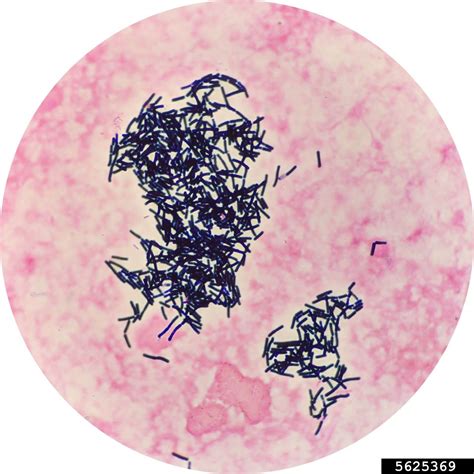 Bacillus thuringiensis microscopique