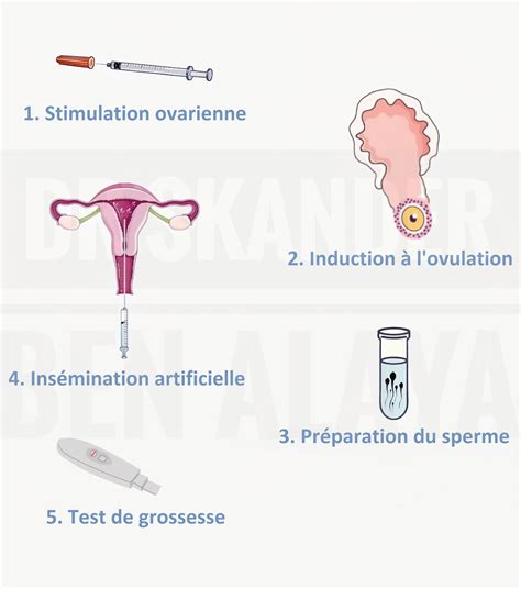 Schéma illustrant le principe général de l'insémination artificielle