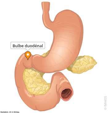 Schéma anatomique illustrant le bulbe duodénal au début de l'intestin grêle