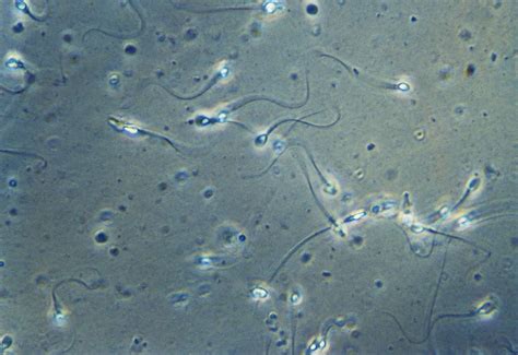 Microscope pour analyse de la motilité des spermatozoïdes