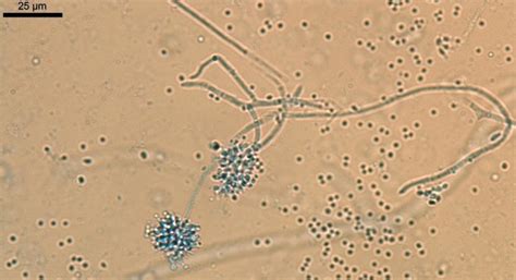 Champignon Beauveria bassiana spores