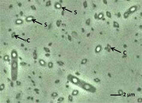 Bacillus thuringiensis au microscope électronique montrant les cristaux parasporaux