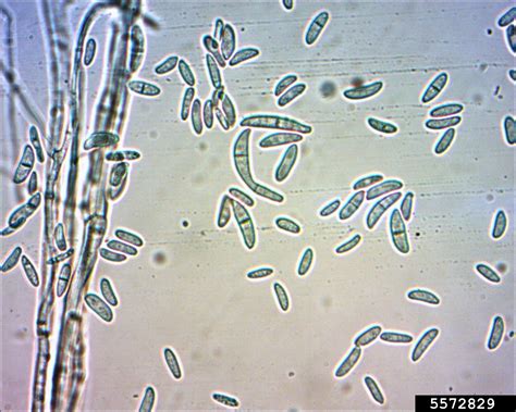 Micrographie de spores de Fusarium