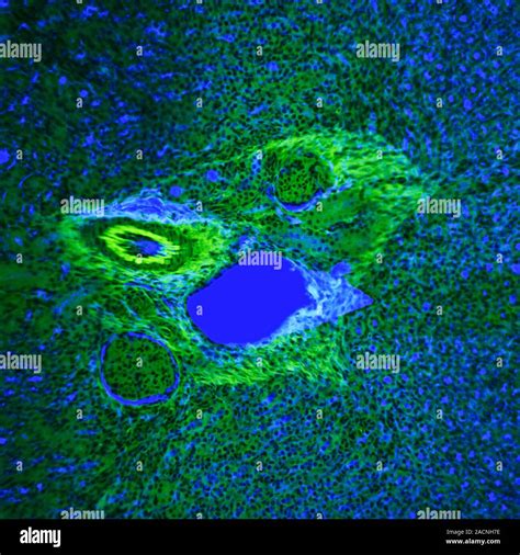 Micrographie confocale haute résolution montrant les neuroblastes marqués en cyan (DCX) entourés des noyaux en rouge (Hoechst)