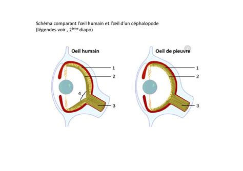 Schéma explicatif montrant la coupe en biais au-dessus d'un œil extérieur