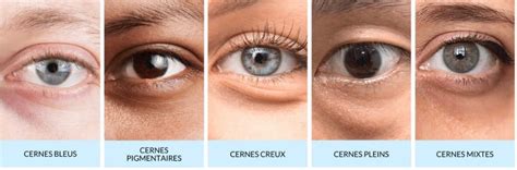 Diagramme des types de cernes