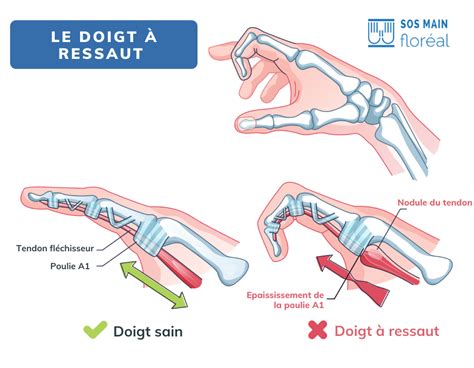 Infographie montrant la méthode du doigt pour vérifier l'humidité du substrat