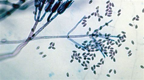 Microscope électronique montrant l'interaction entre Clonostachys rosea et Fusarium graminearum