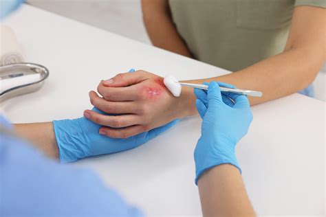 Infographie montrant les gestes de curetage : grattage jusqu'au bois sain, désinfection de la plaie et application du mastic cicatrisant.