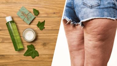 Lierre utilisé en cosmétique pour la cellulite