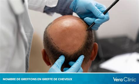 Photo de greffons correctement prélevés et étiquetés