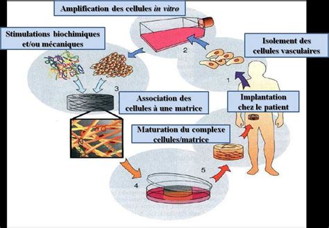 Infographie sur les applications de l'ingénierie tissulaire