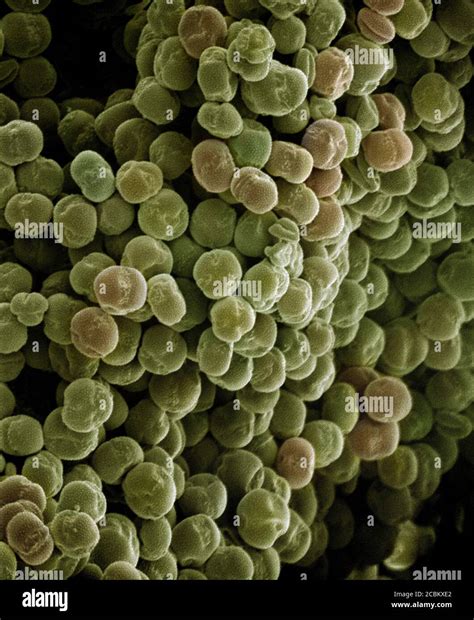 Gros plan microscopique sur une fleur de Wolffia
