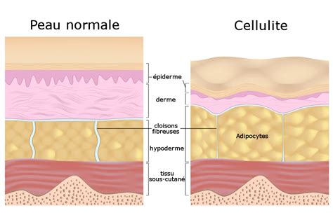 Schéma explicatif de la formation de la cellulite et de l'action de la caféine