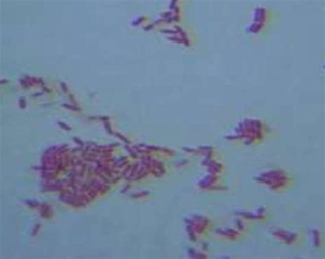 Bacillus thuringiensis au microscope