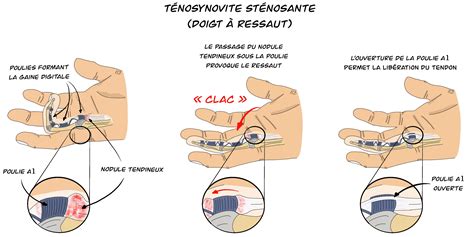 Infographie montrant la méthode du test du doigt à 3-4 cm de profondeur dans le terreau
