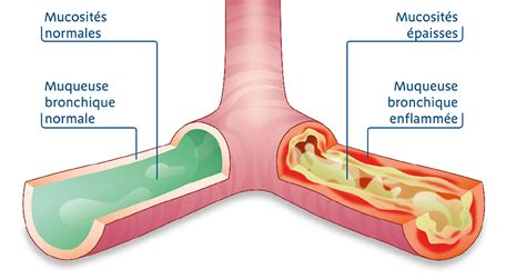 Diagramme illustrant le mécanisme d'action des saponines sur les muqueuses bronchiques